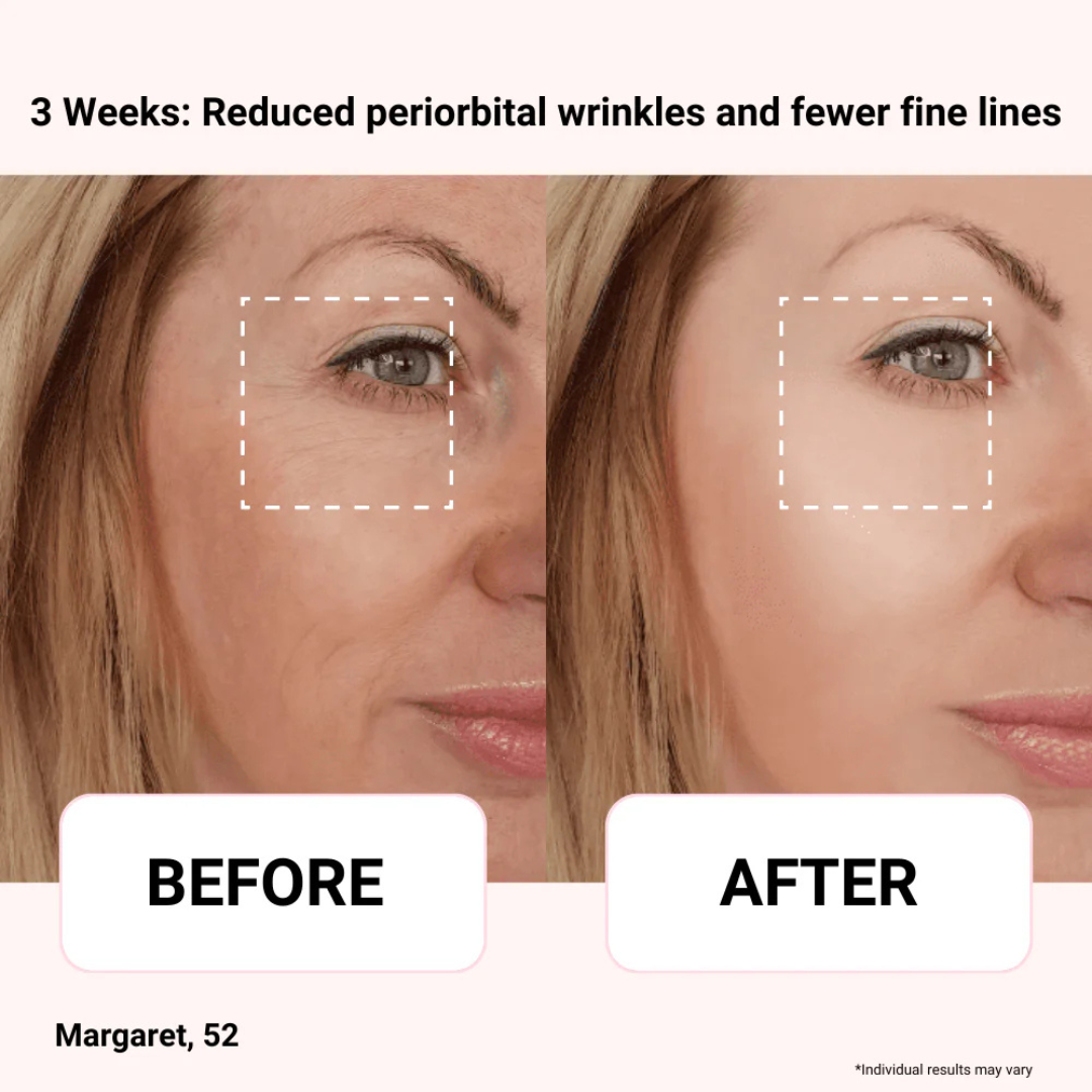 Axis‑Y Vegan Collagen Eye Serum | 100% Authentic Korean Eye Serum