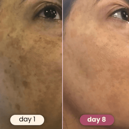 Elara™ Premimum Kojic Acid Turmeric Cleansing Pads