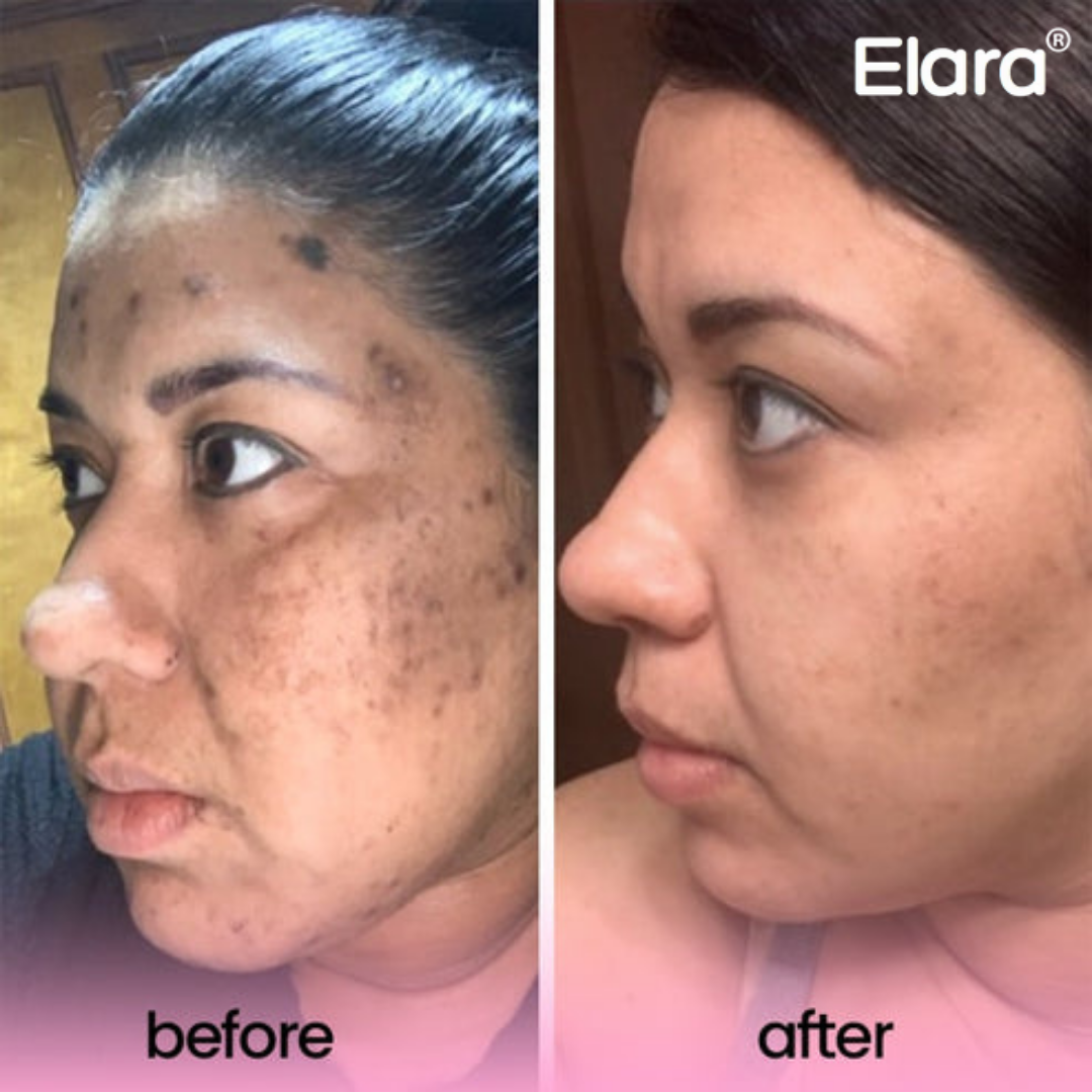 Phor Essentials® Kojic Acid Turmeric Cleansing Pads