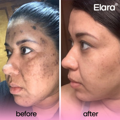 Phor Essentials® Kojic Acid Turmeric Cleansing Pads