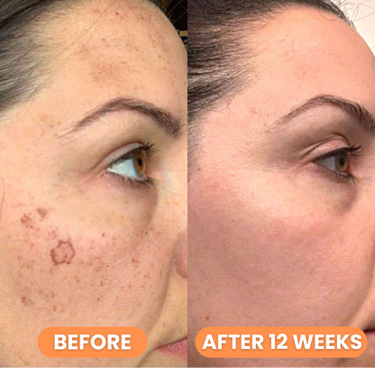 Celimax Pore+Dark Spot Brightening Cream 35ml