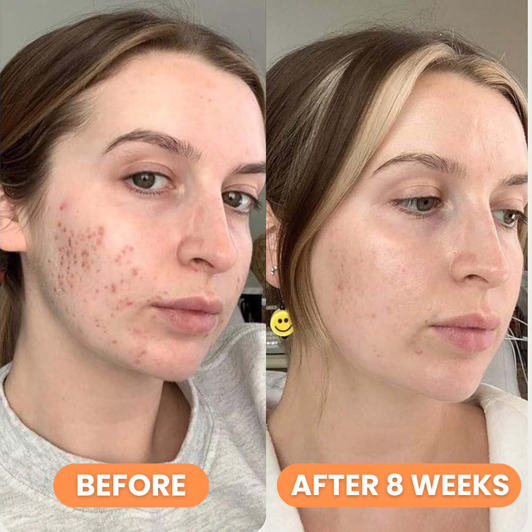 Celimax Pore+Dark Spot Brightening Cream 35ml