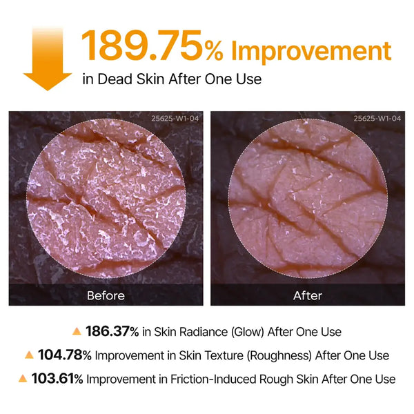 Dr.Melaxin® Peel Shot | Exfoliating Kojic Acid Turmeric Spray 200ml
