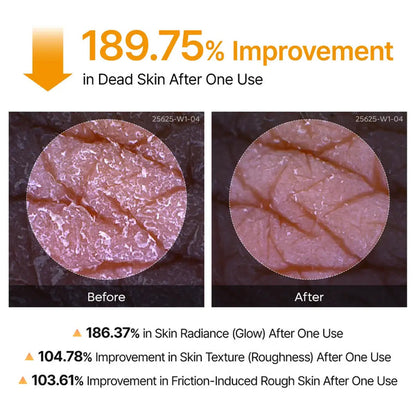 Dr.Melaxin® Peel Shot | Exfoliating Kojic Acid Turmeric Spray 200ml